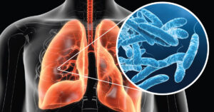 Legionnaires' Disease Prevention: How Thermostatic Valves Can Help Mitigate the Risk